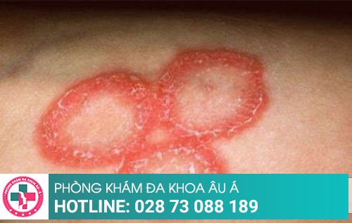 Phòng khám da liễu
