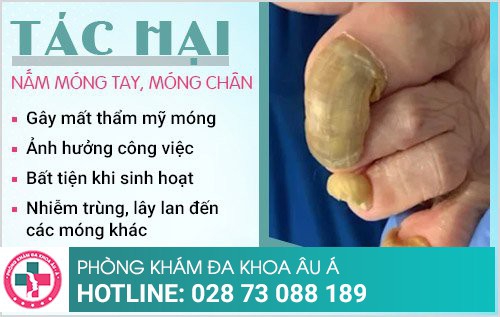 nấm móng chân, nấm móng tay