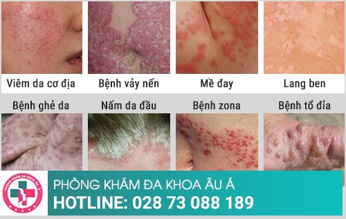Chữa bệnh ngoài da