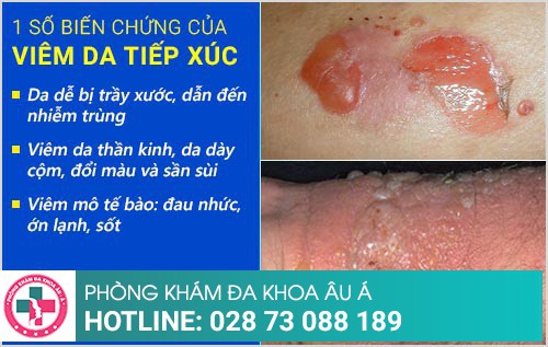Phòng khám da liễu