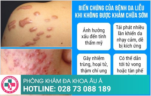 Phòng khám da liễu ngoài giờ