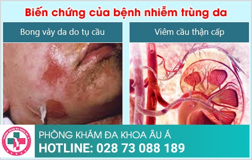 nhiễm trùng da