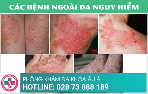 Phòng khám da liễu điều trị bệnh xã hội