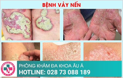 Phòng khám da liễu