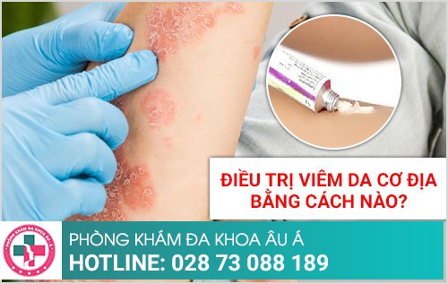 viêm da cơ địa có nguy hiểm không