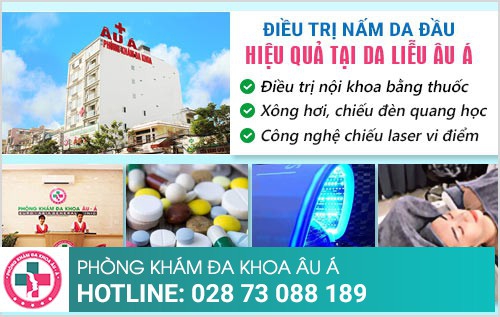 dấu hiệu nấm da đầu