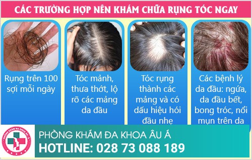 Phương pháp điều trị rụng tóc