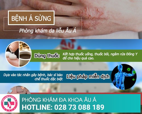 Cách điều trị bệnh á sừng nhanh chóng, hiệu quả