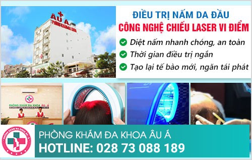 Nấm da đầu cách trị tốt nhất và hiệu quả