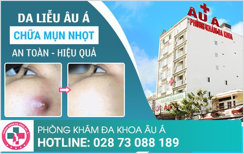 Phương pháp chữa mụn nhọt