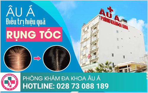 Rụng tóc nam, nữ và những điều cần biết