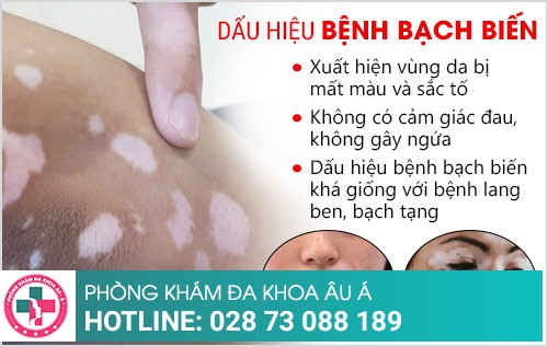 khám bạch biến