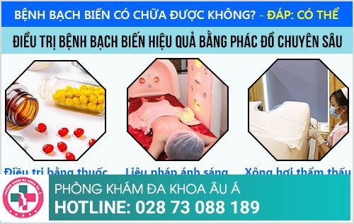 điều trị bạch biến