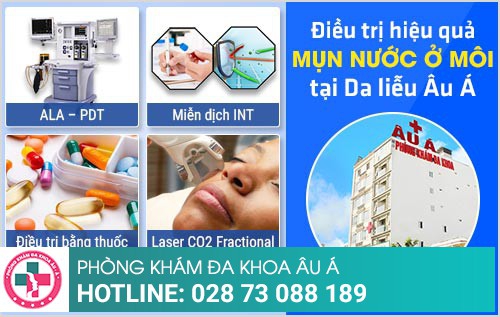 mụn nước ở môi