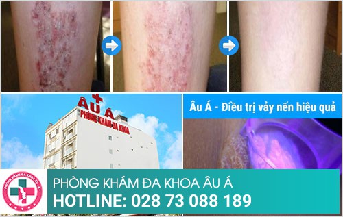 Phòng khám da liễu