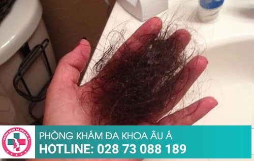 Đột phá điều trị rụng tóc bằng phương pháp hiện đại
