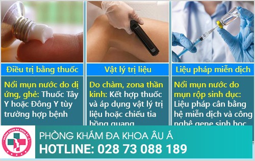 nổi mụn nước