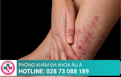 Khám da liễu ở đâu tốt?