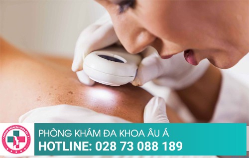 Khám da liễu ở đâu tốt?