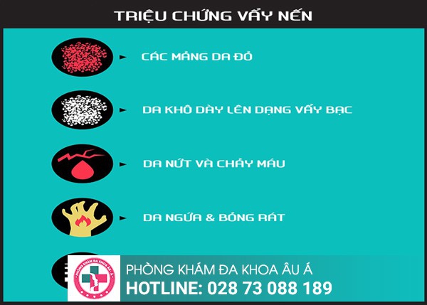 Phòng khám da liễu
