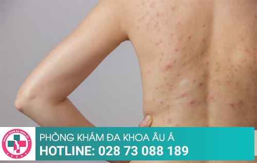 Phòng khám da liễu