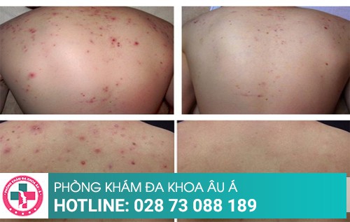 Phòng khám da liễu