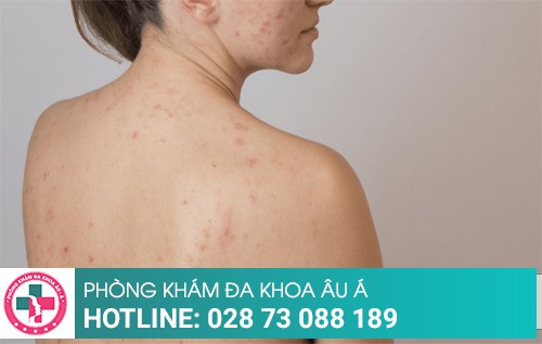 Phòng khám da liễu