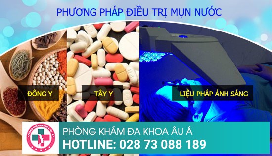 Mụn nước bất thường không phải chuyện đơn giản