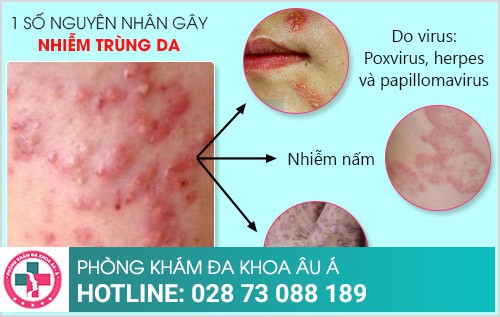 nhiễm trùng da