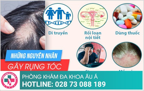 điều trị rụng tóc ở đâu