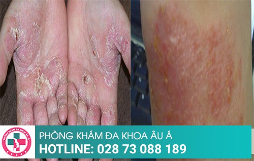 Phòng khám da liễu