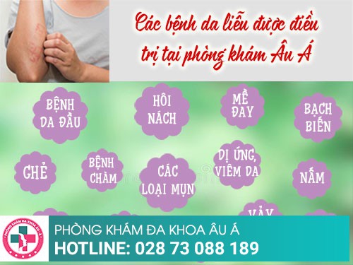 Phòng khám da liễu uy tín nhất hiện nay tại TPHCM