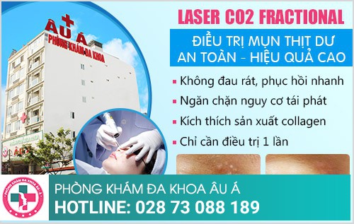 Mụn thịt và giải pháp hỗ trợ điều trị hiệu quả