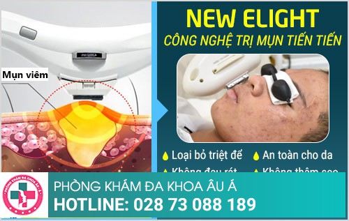 điều trị mụn ở đâu