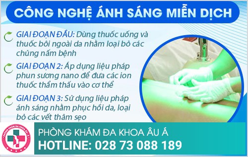 Điều trị nấm da bằng công nghệ ánh sáng miễn dịch