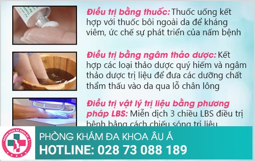 Địa chỉ điều trị lang ben tốt nhất tại TP.HCM