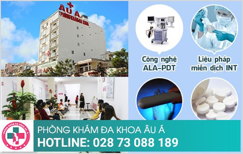 Nổi mụn quanh miệng