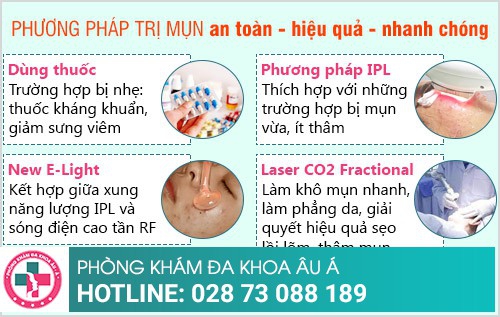 Phương pháp trị mụn