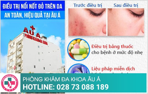 nổi nốt đỏ và ngứa trên da