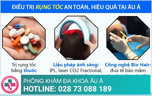 Phương pháp điều trị rụng tóc