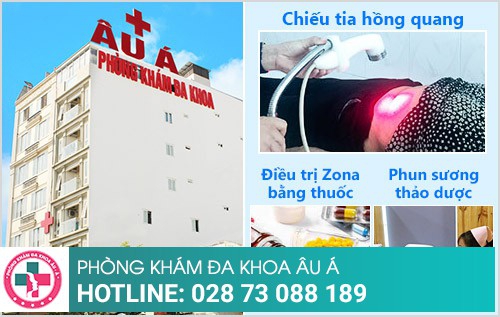 biến chứng zona thần kinh