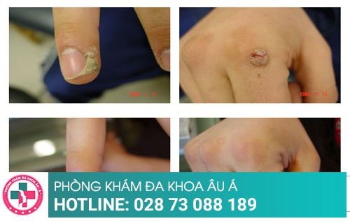 Phòng khám da liễu