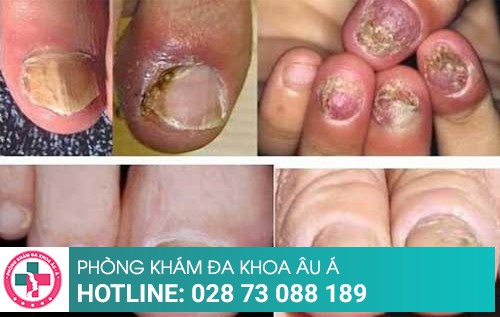 Phòng khám da liễu