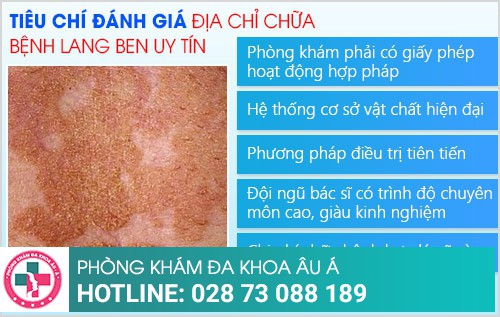 Địa chỉ điều trị lang ben tốt nhất tại TP.HCM