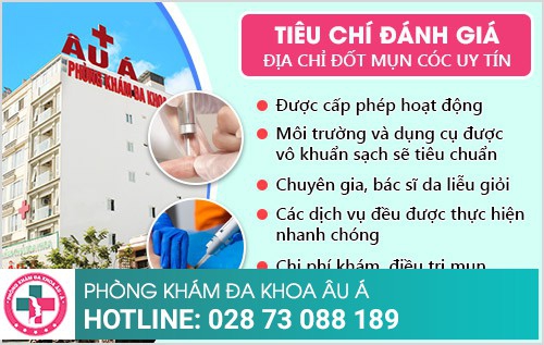 đốt mụn cóc ở đâu