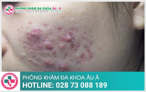 Phòng khám da liễu