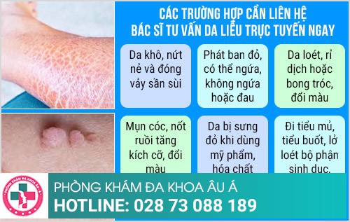 Phòng khám da liễu