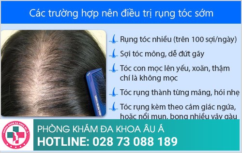 Nên điều trị rụng tóc ở đâu tại TPHCM?