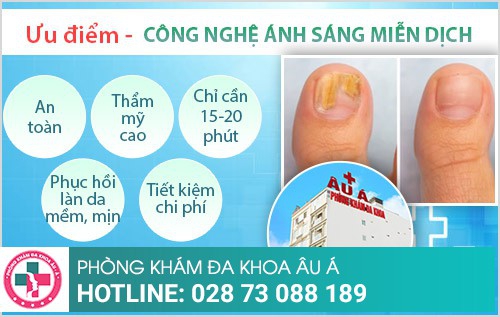 Điều trị nấm da bằng công nghệ ánh sáng miễn dịch