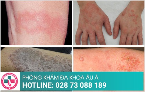 Phòng khám da liễu